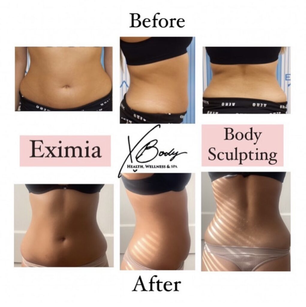 Eximia Before and After